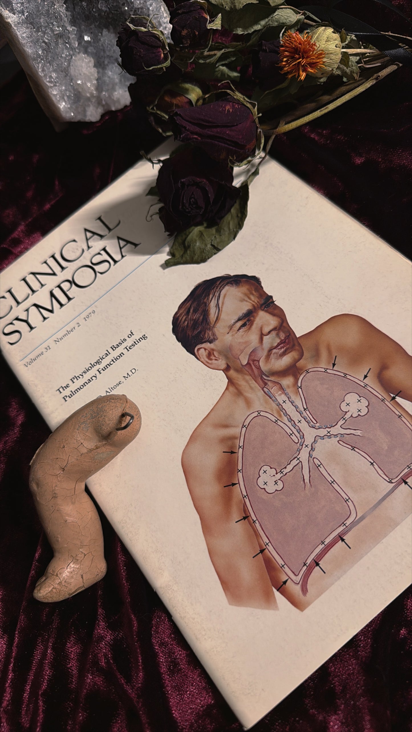 #85 ONE LEFT! 1970s Vintage Clinical Symposia books (set option)