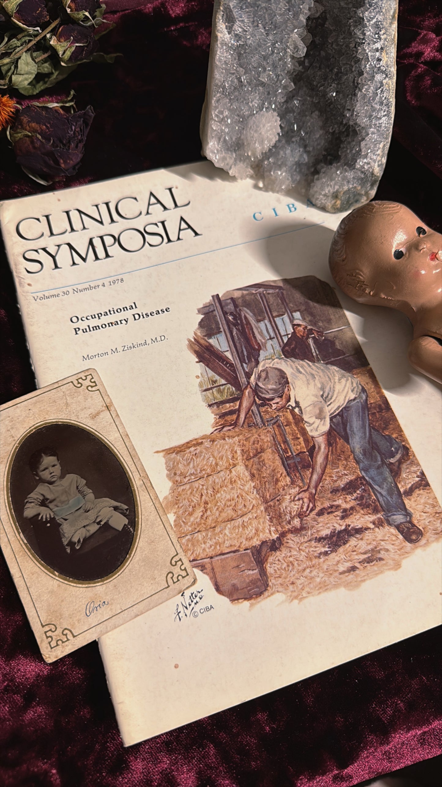 #85 ONE LEFT! 1970s Vintage Clinical Symposia books (set option)