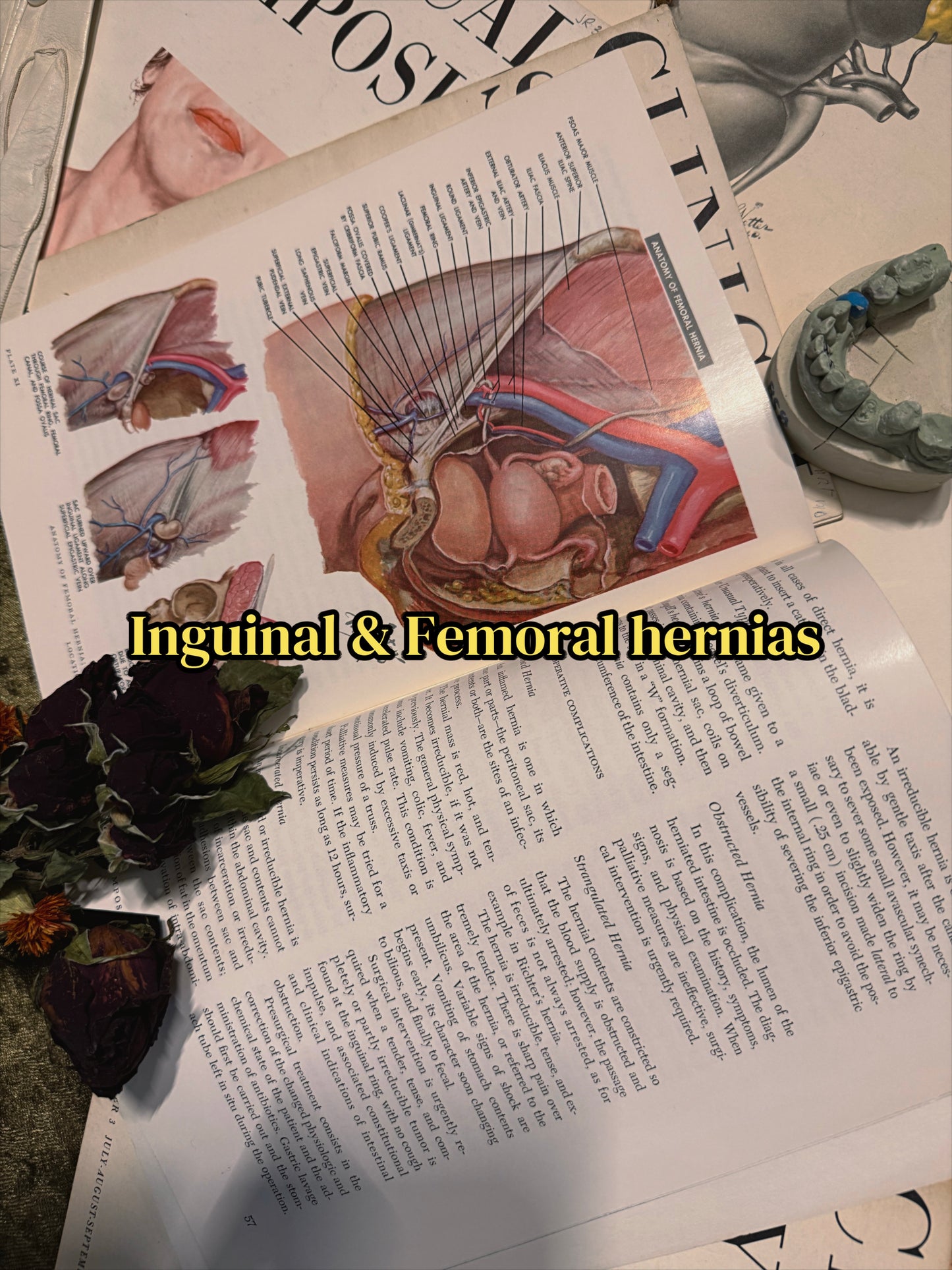 #74 1960s Vintage Clinical Symposia books