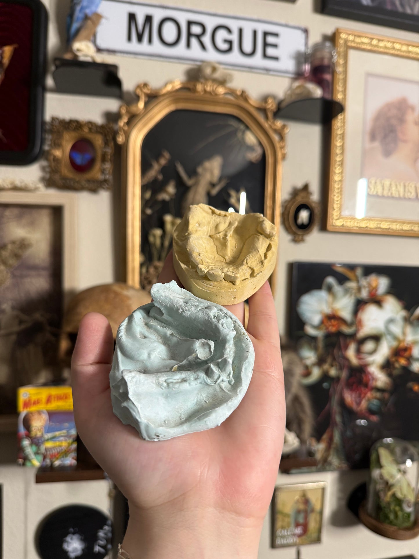 #79 1850s- Late 1900s Dental Molds