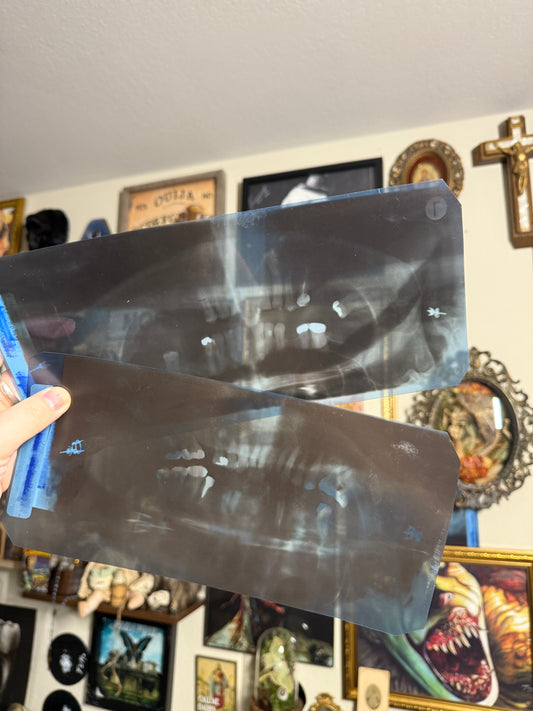 #80  Early 1900s Large Dental X-ray