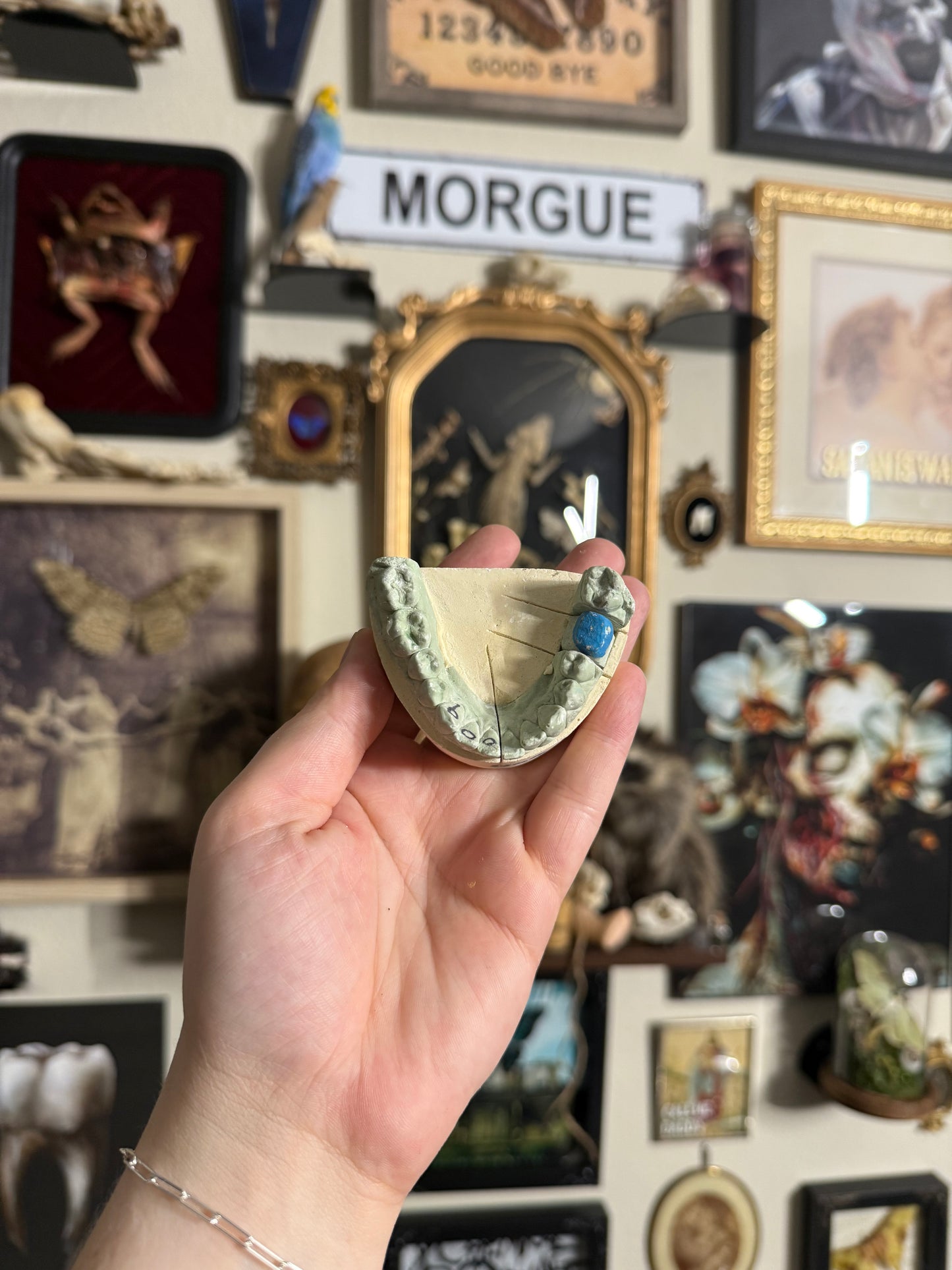 #79 1850s- Late 1900s Dental Molds