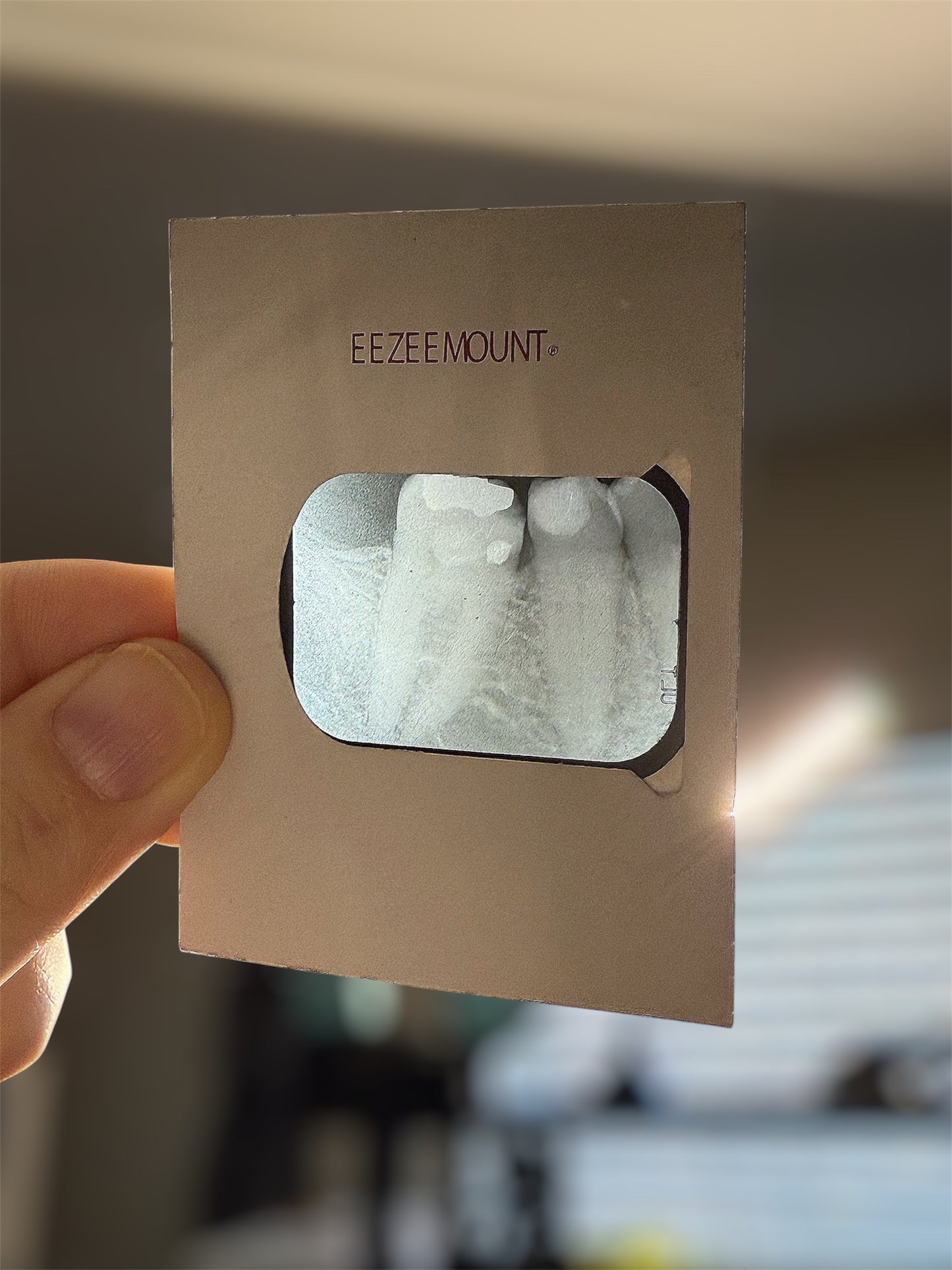 #77 Early 1900s Dental X-rays