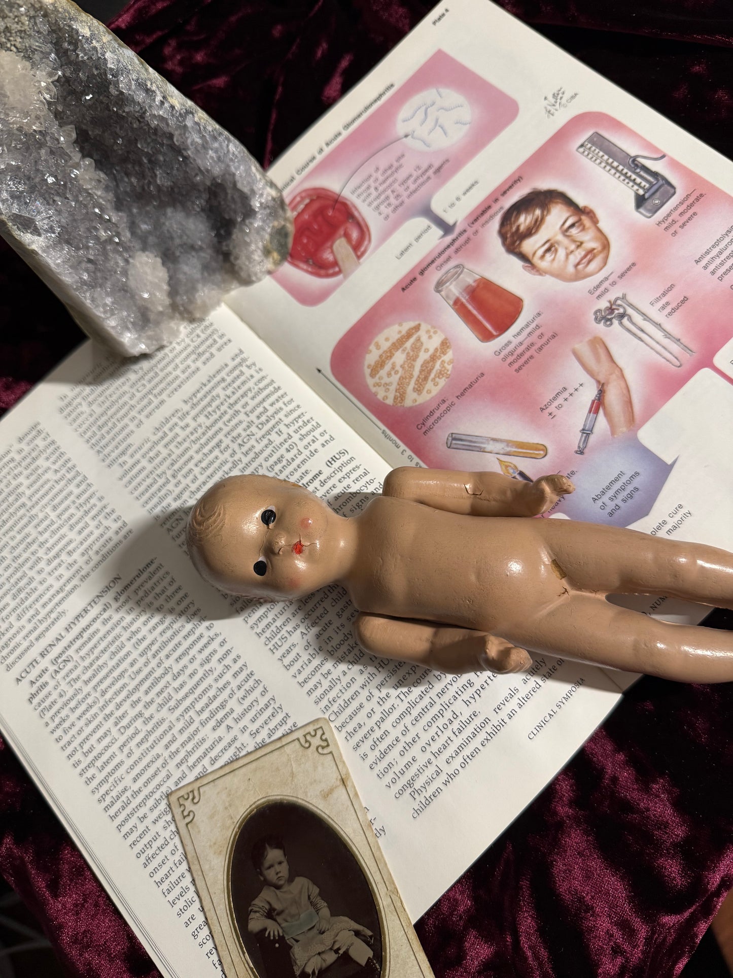 #85 ONE LEFT! 1970s Vintage Clinical Symposia books (set option)