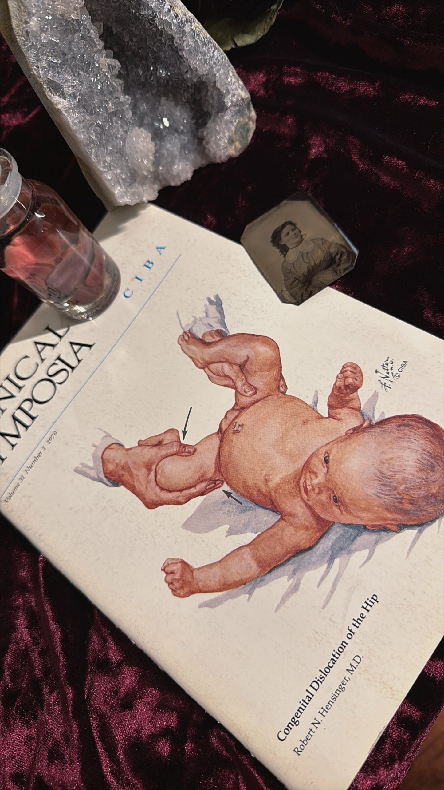 #85 ONE LEFT! 1970s Vintage Clinical Symposia books (set option)