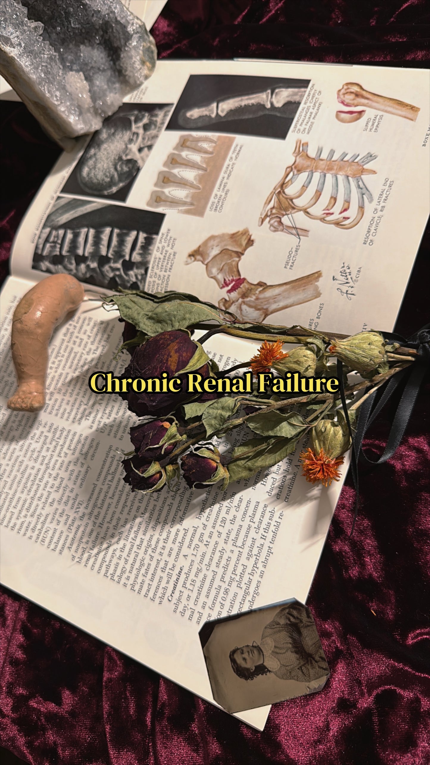 #85 ONE LEFT! 1970s Vintage Clinical Symposia books (set option)