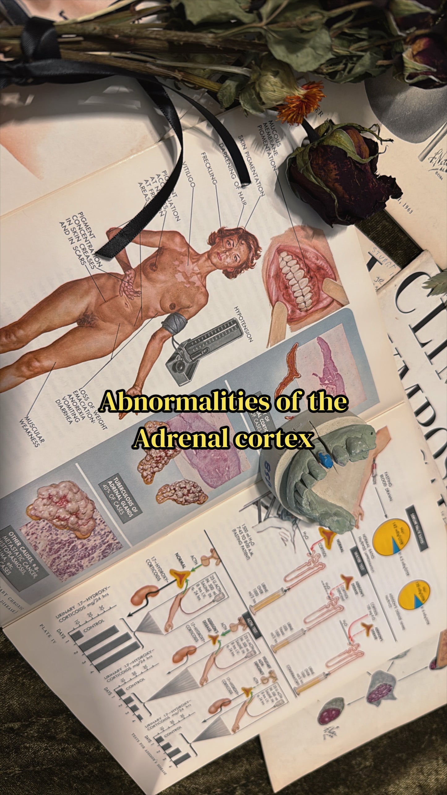 #74 1960s Vintage Clinical Symposia books