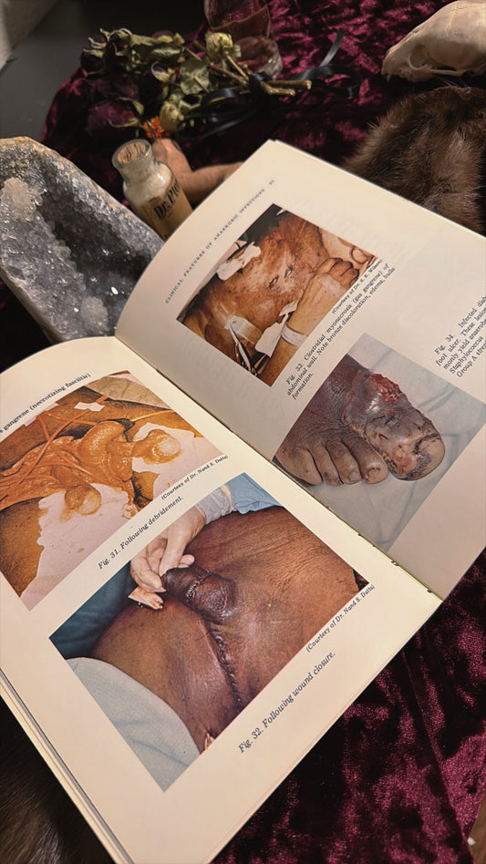 #86 1976 (1ct) Vintage Diagnosis & Management of Anaerobic Infections