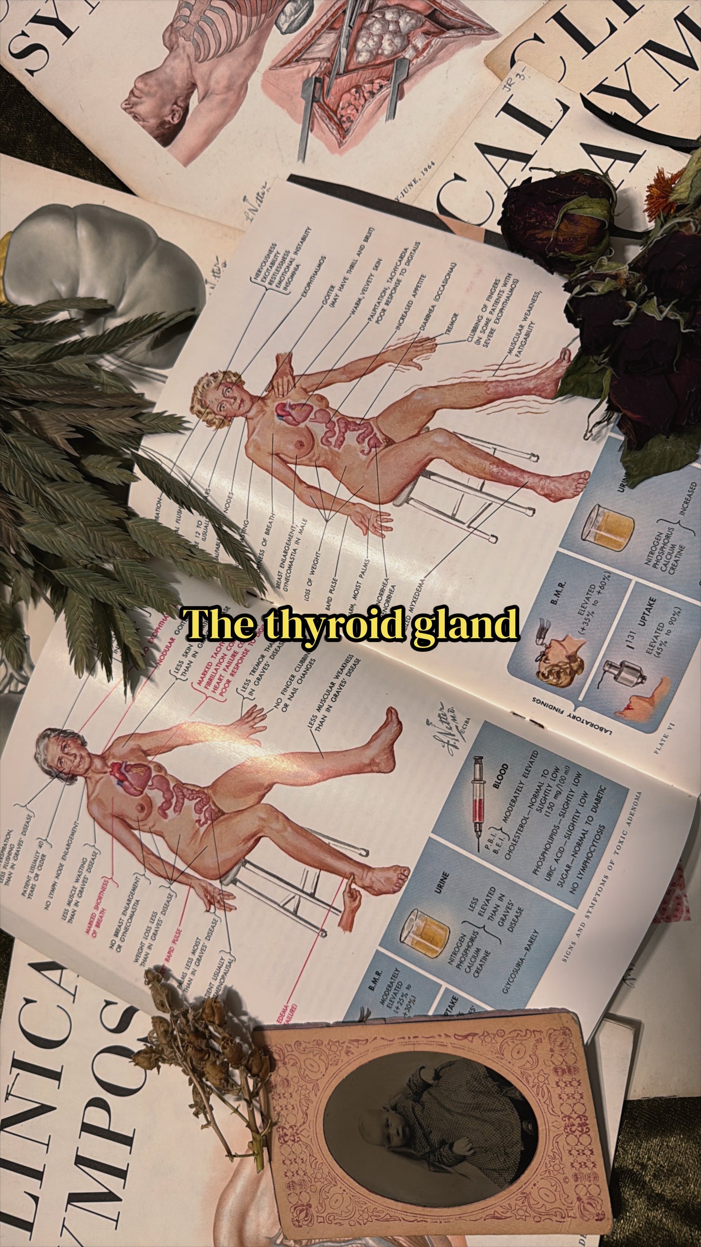 #74 1960s Vintage Clinical Symposia books