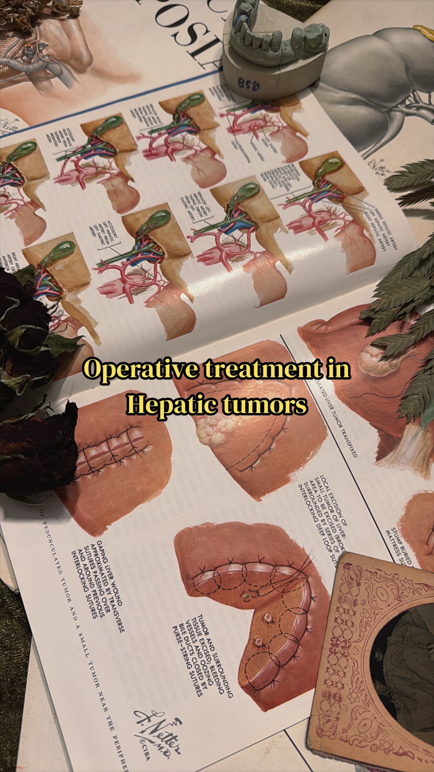 #74 1960s Vintage Clinical Symposia books