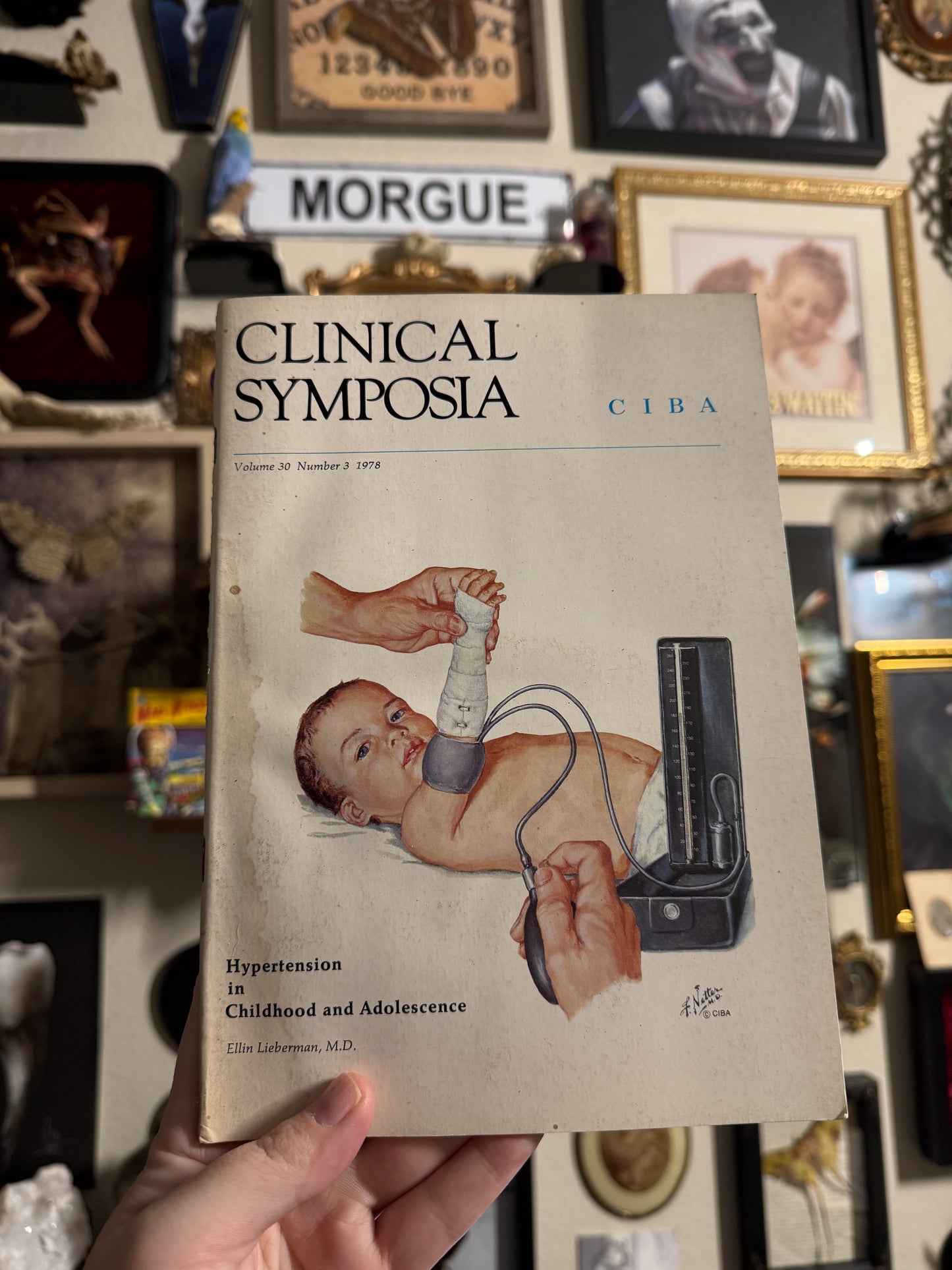 #85 ONE LEFT! 1970s Vintage Clinical Symposia books (set option)